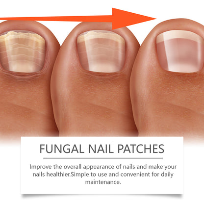 Ximonth Nail Care Patches for Nail Repair &amp; Easy Cleaning shown improving nail appearance for healthier nails.