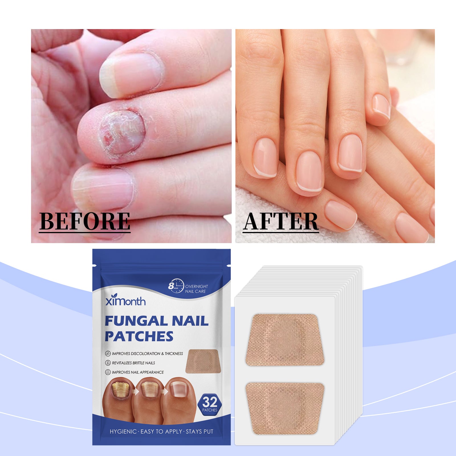 Ximonth Nail Care Patches for Nail Repair &amp; Easy Cleaning before and after nail transformation with patches