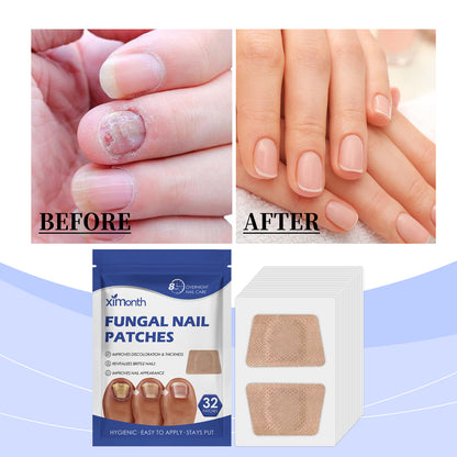 Ximonth Nail Care Patches for Nail Repair &amp; Easy Cleaning before and after nail transformation with patches